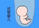 培养太原捐卵宝宝艺术细胞的小技巧